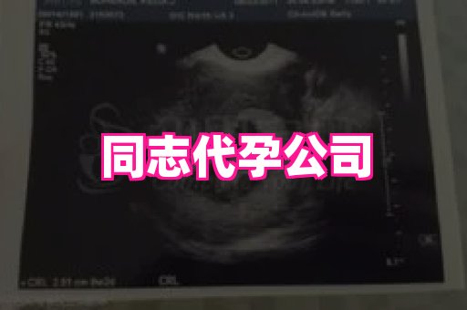 长春助孕网 4